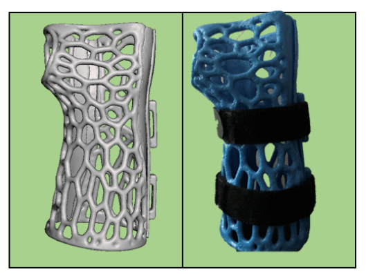 side-by-side of 3D computer rendering of the support, and a prototype
